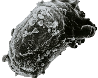 AFC Life Science UTSUKUSHHII - Patent No JP3040711B2 AntiTumor